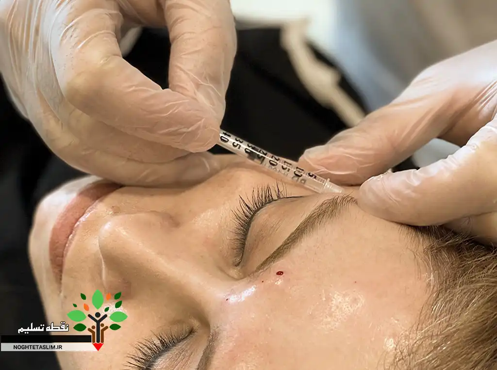 انجام ژل و بوتاکس در آرایشگاههای قزوین ممنوع است